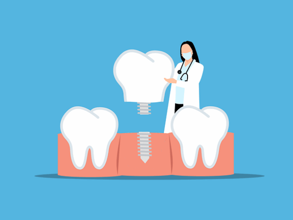 dent-removal-process-640x480-94115824.png